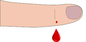 Bleeding finger