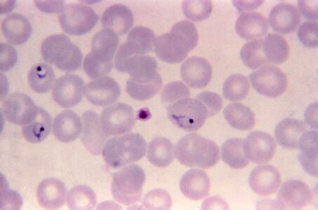 Film form plasmodium photo