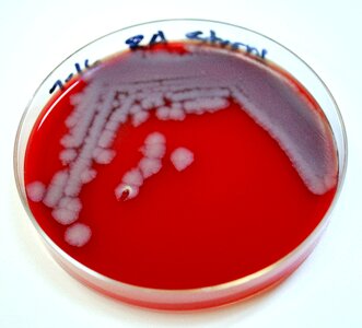 Bacillus blood blood agar