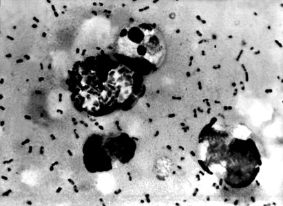 Bacteria bubonic plague cervical smear
