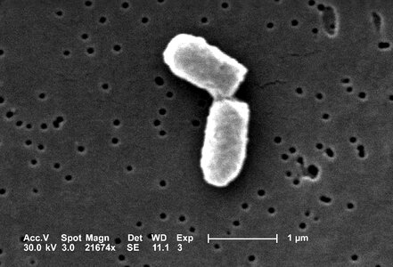 Bacteria cell escherichia photo