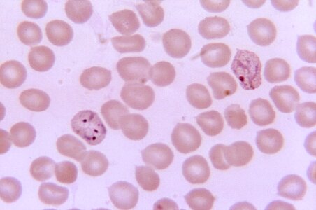 Form law plasmodium