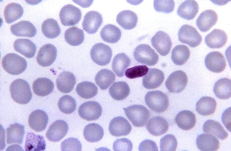 Artifact malaria parasit