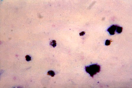 Ancient crescent plasmodium