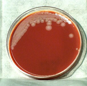 Aerobe bacillus spore photo