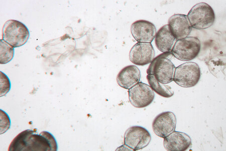 Glochidia under microscope-2