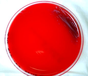 Bacteria blood agar celsius photo