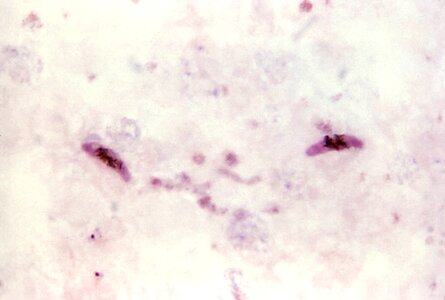 Cytoplasm pinkish plasmodium photo