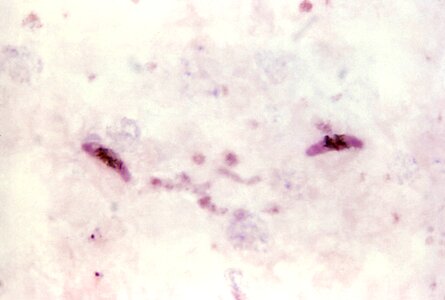 Cytoplasm pinkish plasmodium
