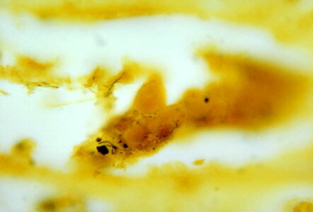 Bacteria kidney photomicrograph