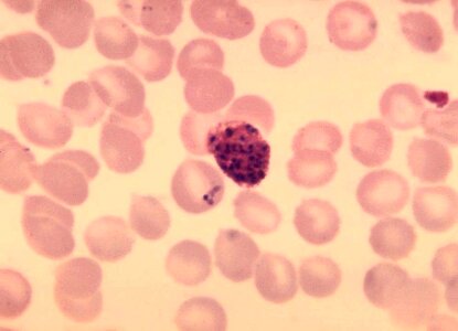 Parasit plasmodium 