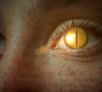 Yellow eyebrow freckles