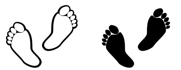 Foot sole orthopedic