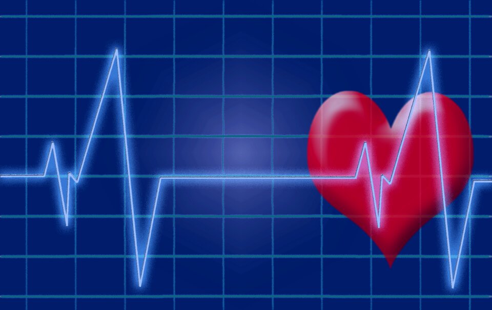 Ecg electrocardiogram medical