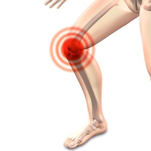 Osteoarthritis knee Free illustrations