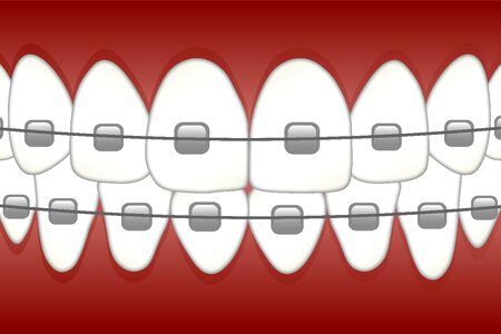 Dentistry orthodontics tooth