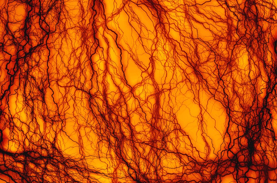 Blood vessel illustration Free illustrations
