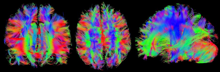 Head tractography nerves
