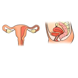 Uterus shape the uterus model Free illustrations