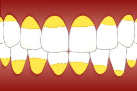 Tartar white spot