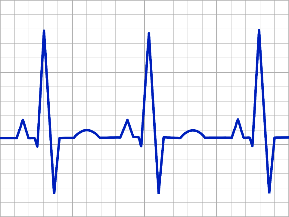 Frequency electrocardiogram medical