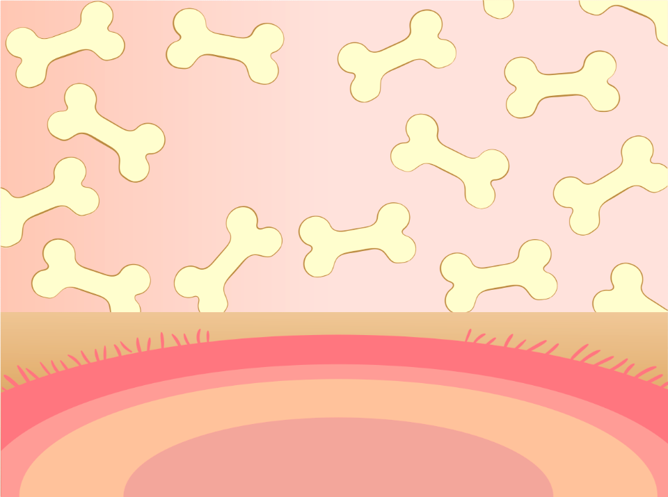 Bones