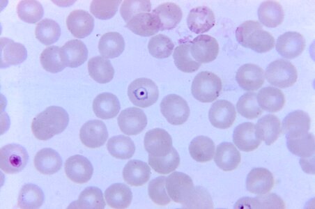 Center chromatin landmass photo