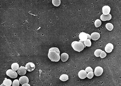Bacteria positive 