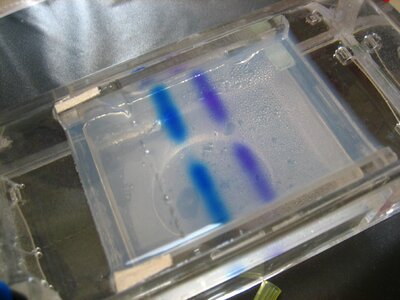 Chemical electrophoresis labor photo