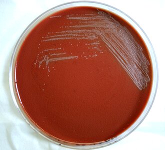 Bacteria petri dish plague photo
