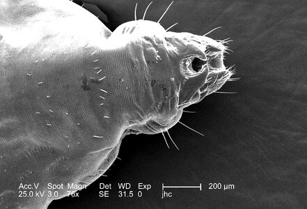 Image morphologic 