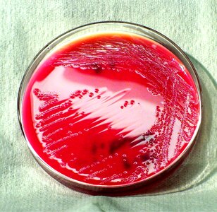 Bacteria gram negative photo