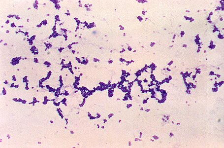 Bacteria gram photomicrograph photo