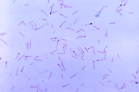 Bacteria cell clostridium photo