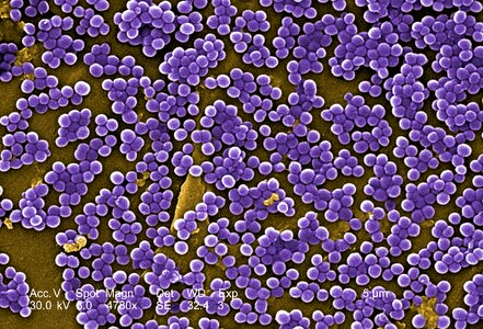 Methicillin  