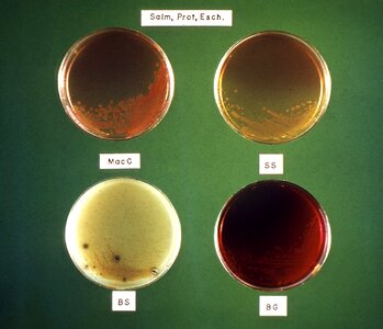 Bacteria culture media