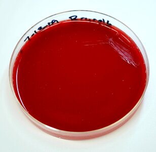 Abortus blood blood agar photo