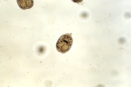 Echinococcus magnification photomicrograph photo