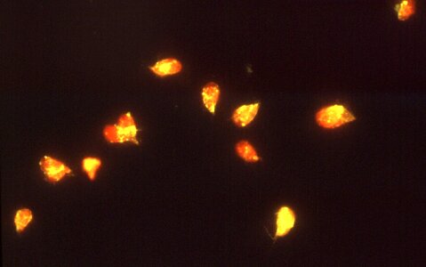 Dilution evidence giardia