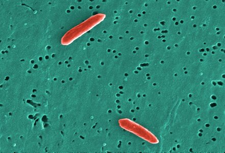 Bacteria gram negative