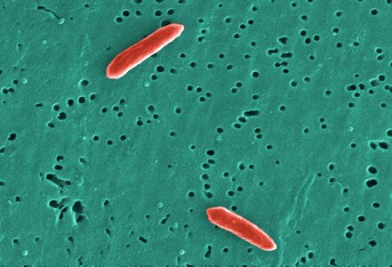 Bacteria gram negative photo