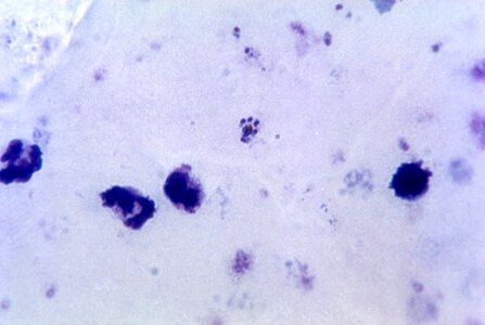 Cytoplasm pigment rosette photo