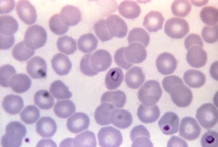 Form plasmodium ring photo