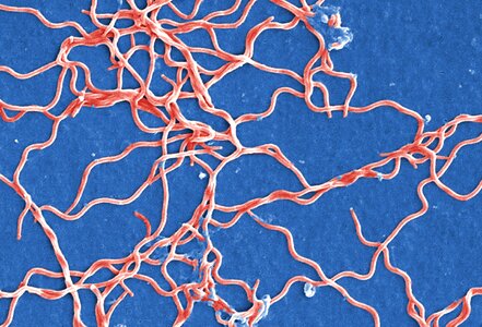 Bacteria Borrelia spirochaetaceae gram photo