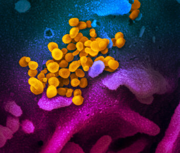 COVID-19 virus Coronavirus disease photo