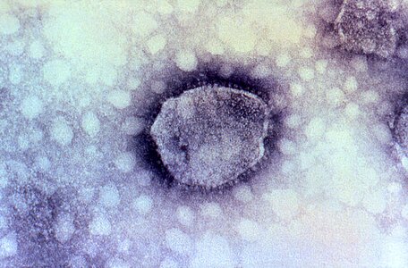 Complex electron electron micrograph
