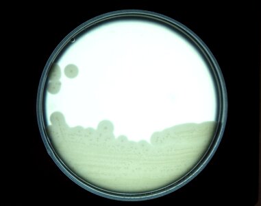 Clostridium egg egg yolk photo