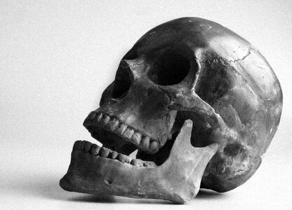 Skull color teeth