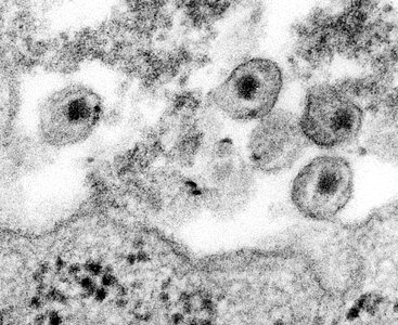 Human immunodeficiency virus photo