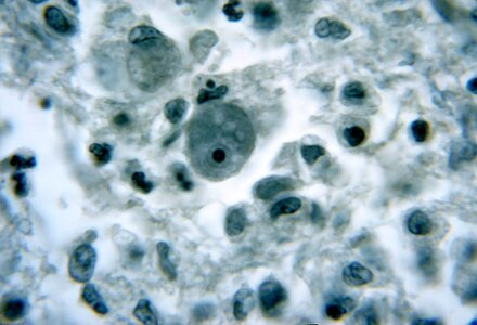 Sample tissue 